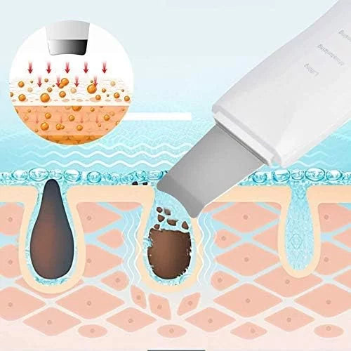Ultrasonic skin scrubber