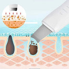 Ultrasonic skin scrubber