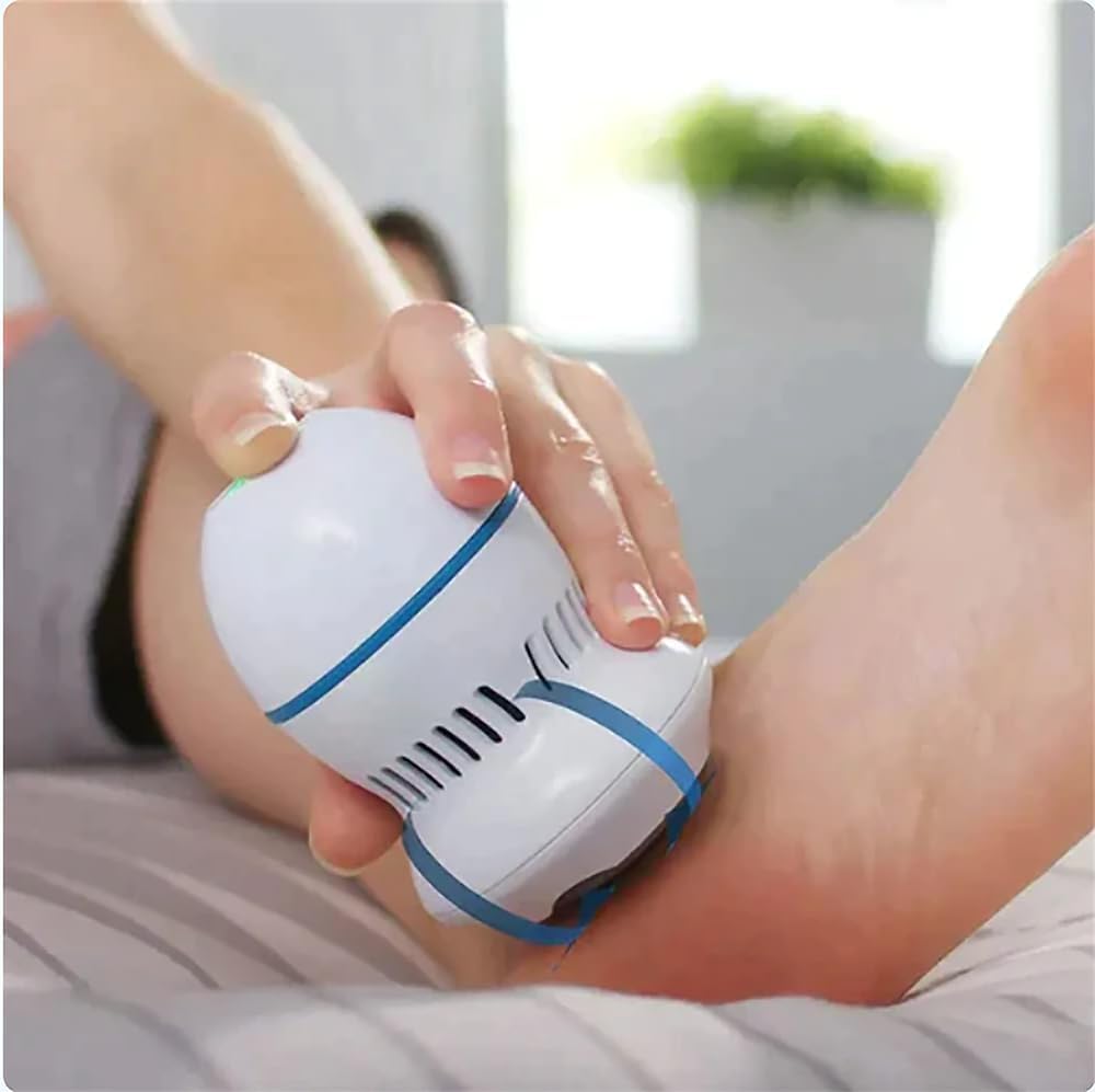 Electric callus remover