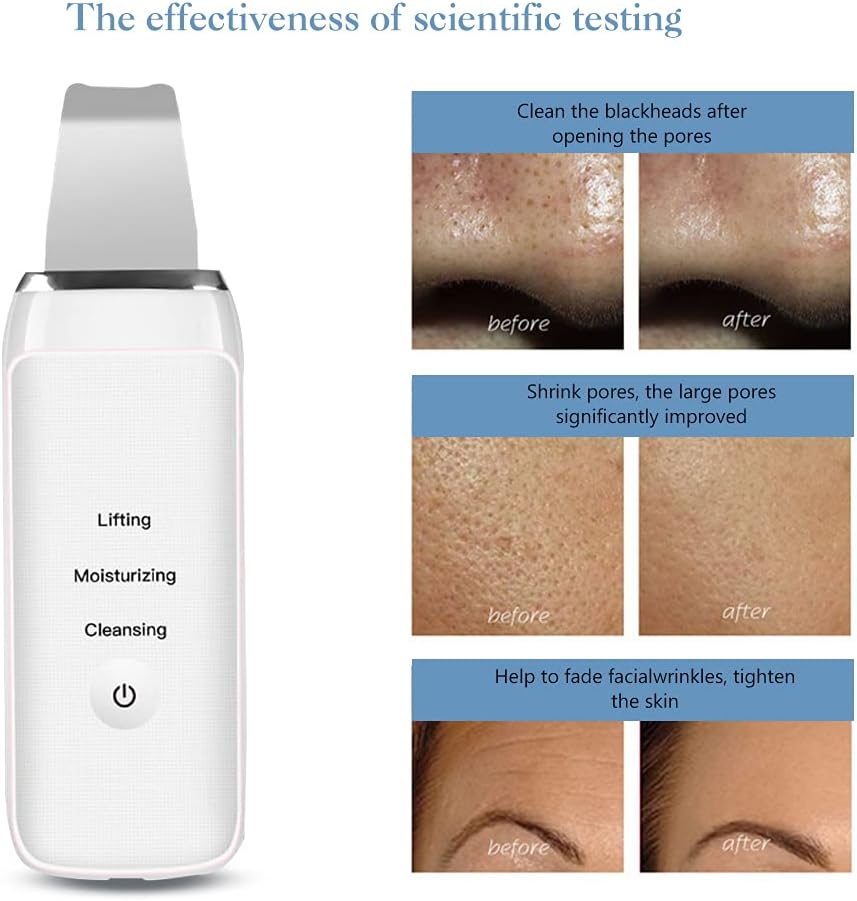 Ultrasonic skin scrubber