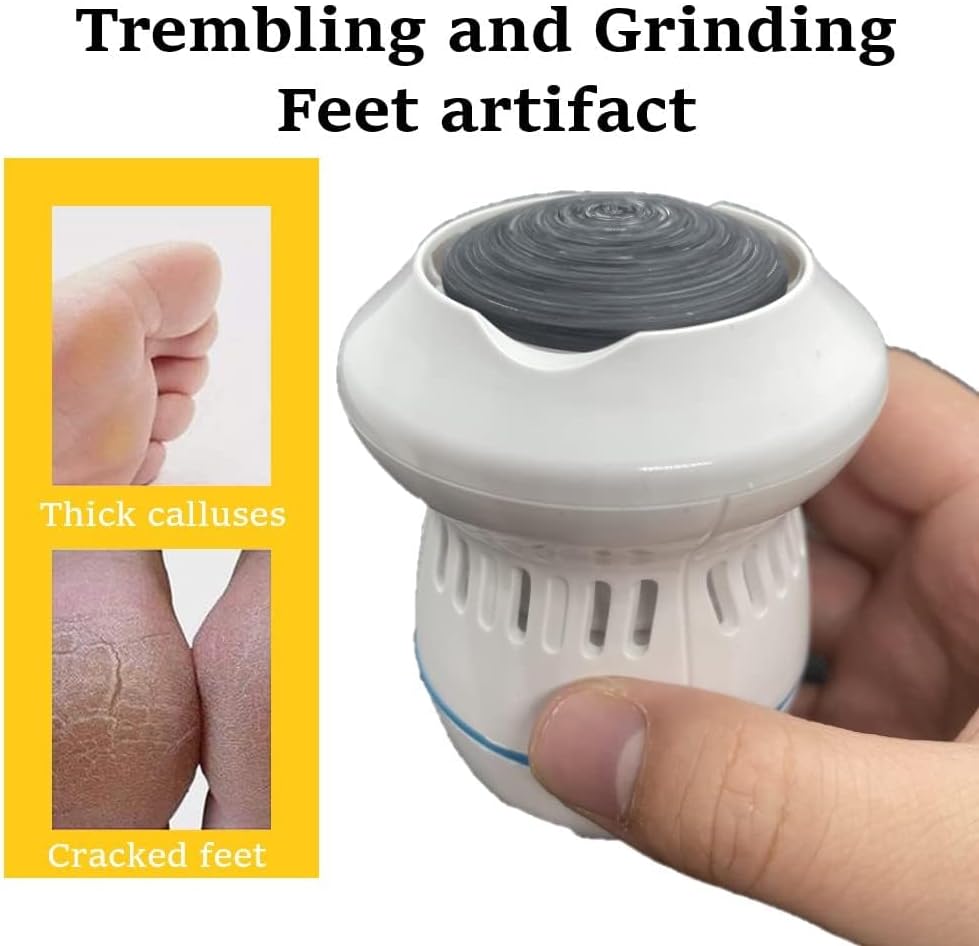 Electric callus remover