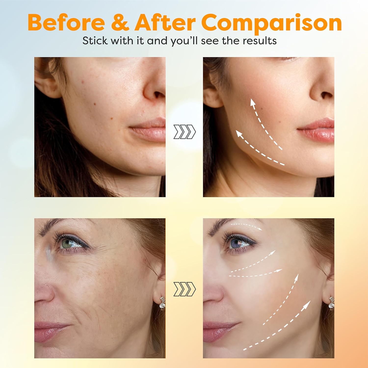Before and after comparison of facial treatment results with text 'Stick with it and you'll see the results'.